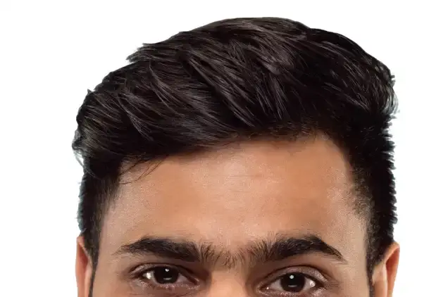 exosome therapy for hair